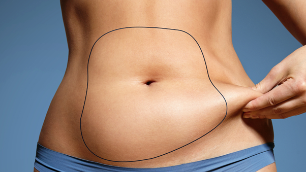 Abdomminal liposuction