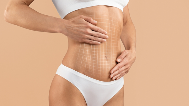 Tummy tuck