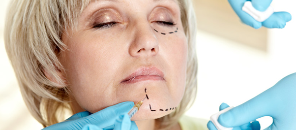 Facelift by surgery