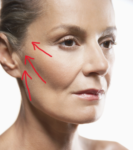 Deep plane facelift vs. Traditional method: Which is right for You?