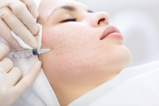 How often should you get skin booster injections?