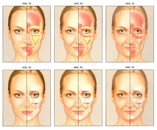 No more tired eyes: How under-eye fat transfer rejuvenates your look ?