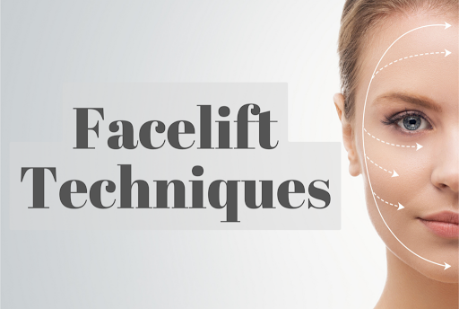Best technique for Facelift: Achieving natural
