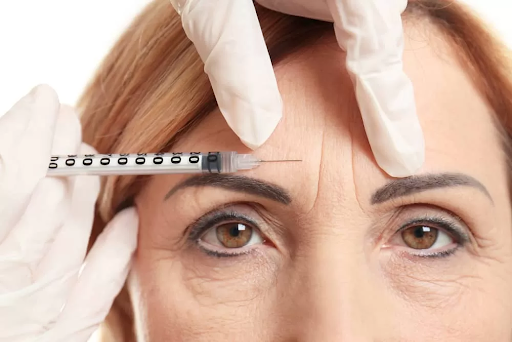 Forehead 's wrinkles removal by botox injections