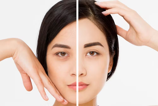 Spock eyebrow after botox injection: How can you correct that?