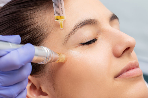 PRP for rejuvenation face - Everything you need to know