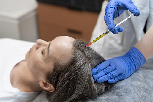 PRP for recovering hair loss - A comprehensive guide