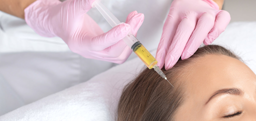 PRP for recovering hair loss - A comprehensive guide