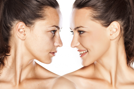 Fat transfers for the face: A natural approach to facial rejuvenation