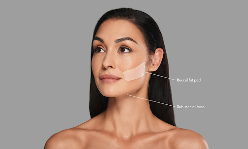 Buccal fat removal method
