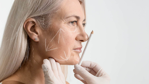 Why is surgical facelift indicated on severely aging faces?