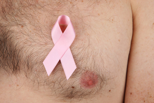 Basic reasons leading to male breast disease?