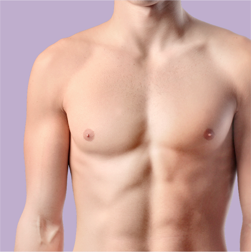 Basic reasons leading to male breast disease?