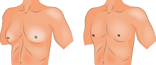Basic reasons leading to male breast disease?