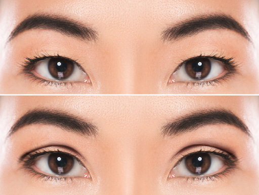 European eye aging improvement method