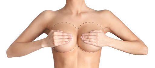 Is breast augmentation safe?
