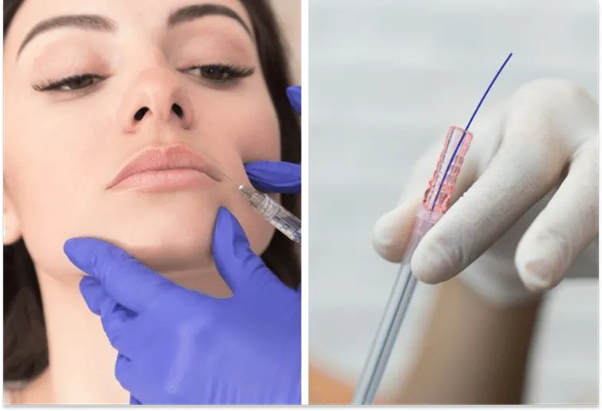 Fillers or thread lifts