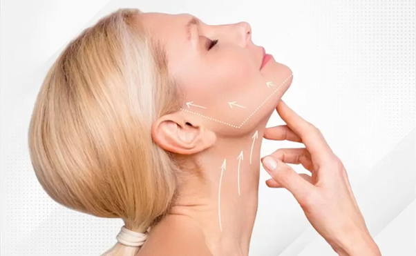 Neck Lift