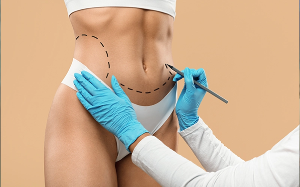 Vaser Liposuction