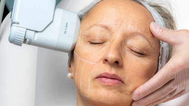Non-surgical facial rejuvenation