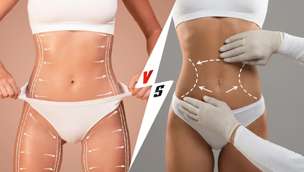 tummy tuck and liposuction