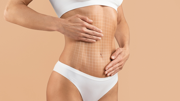 Tummy Tuck
