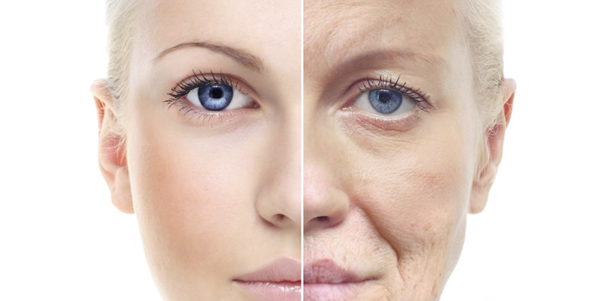 Facial aging
