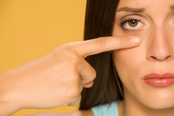 Lower Eyelid Bags